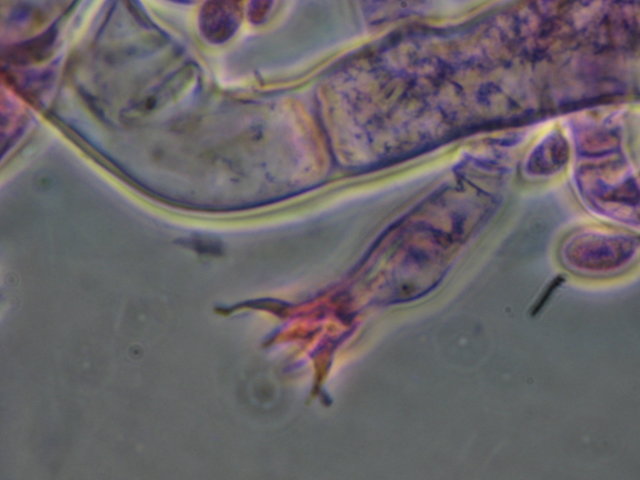 Botryobasidium con spore finemente verrucose